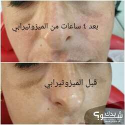 Eye Lash Salon صالون اي لاش