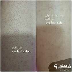 Eye Lash Salon صالون اي لاش