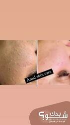 Amal Skin Care