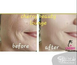 مركز تجميل شيري بيوتي Cherry beauty lounge | خبيرة البشره شيرين سالم‏