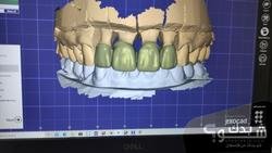 عيادة الأنوار لطب الاسنان 