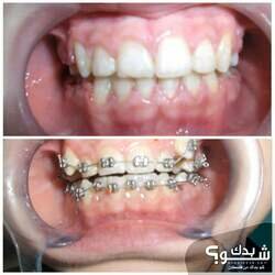 عيادات ابتسامات النجوم لطب الاسنان