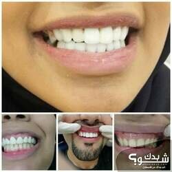 عيادات ابتسامات النجوم لطب الاسنان