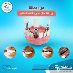 عيادة الدكتور علاء الخطيب