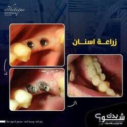  الدكتور فادي يونس العاصي Dr. Fadi Y. Assi