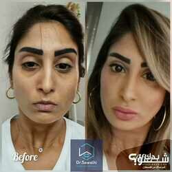 صوالحي دنت