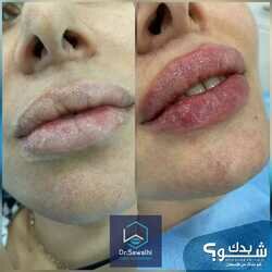 صوالحي دنت