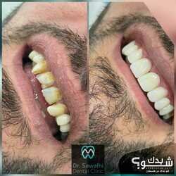 صوالحي دنت