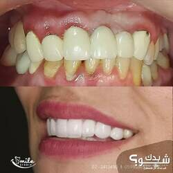 Smile Studio Dental Clinic الدكتورة شذى الهندي و الدكتور مراد أبو عصب