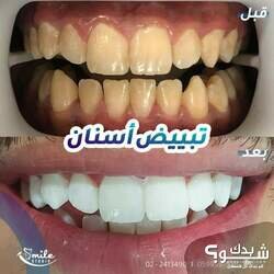 Smile Studio Dental Clinic الدكتورة شذى الهندي و الدكتور مراد أبو عصب