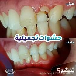 Smile Studio Dental Clinic الدكتورة شذى الهندي و الدكتور مراد أبو عصب