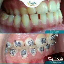 Smile Studio Dental Clinic الدكتورة شذى الهندي و الدكتور مراد أبو عصب