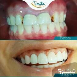 Smile Studio Dental Clinic الدكتورة شذى الهندي و الدكتور مراد أبو عصب