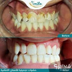Smile Studio Dental Clinic الدكتورة شذى الهندي و الدكتور مراد أبو عصب