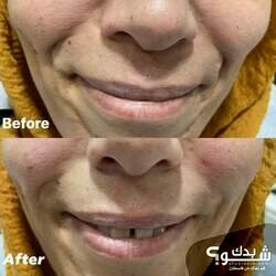 I-Smile Dental Clinic الدكتور بهاء الزغير و الدكتورة شفاء الشمالي 