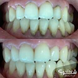 I-Smile Dental Clinic الدكتور بهاء الزغير و الدكتورة شفاء الشمالي 