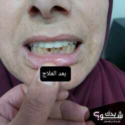العيادة الروسية لطب وزراعة الاسنان