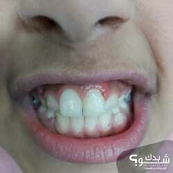 العيادة الروسية لطب وزراعة الاسنان