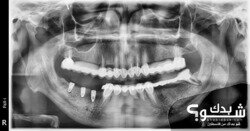 العيادة الروسية لطب وزراعة الاسنان