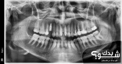 العيادة الروسية لطب وزراعة الاسنان