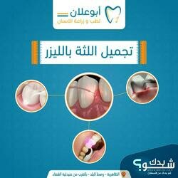 عيادات ابو علان لطب الاسنان 