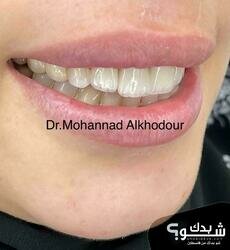 Prodental clinic عيادات الدكتور مهند الخضور 