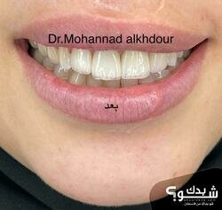 Prodental clinic عيادات الدكتور مهند الخضور 