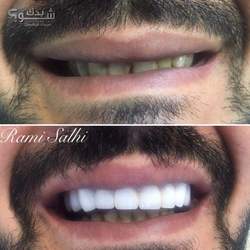 الدكتور رامي عمر الصالحي
