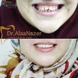 د. علاء جميل الناظر - ازمير لطب الاسنان