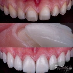 Dental Land عيادة الدكتورة نسرين قشقيش