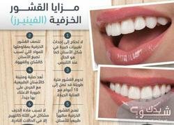 Dental Land عيادة الدكتورة نسرين قشقيش