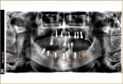 عيادة سمايل دينت Smile Dent Clinic